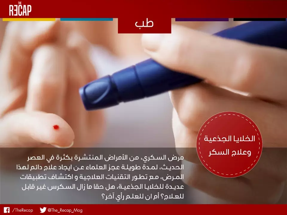 الخلايا الجذعية وعلاج السكر