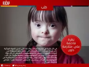 متلازمة داون