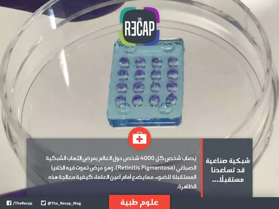مرض التهاب الشبكية الصباغي