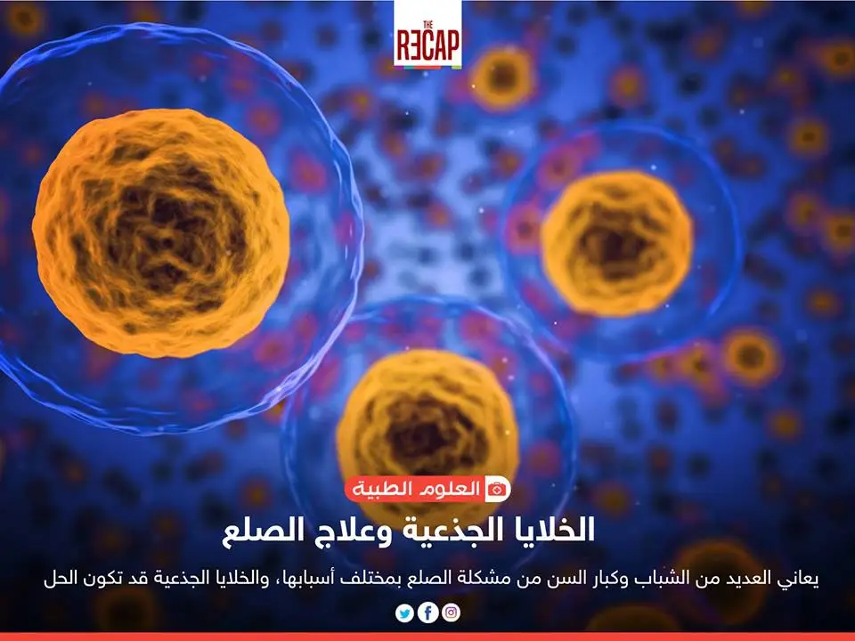 الخلايا الجذعية وعلاج الصلع