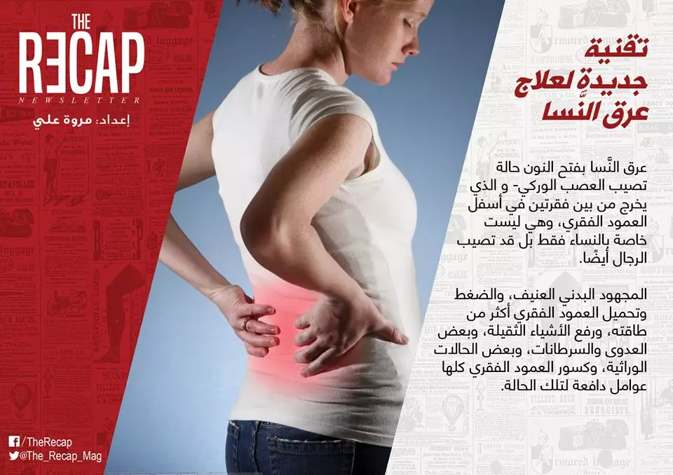 تقنية جديدة لعلاج عرق النَّسا