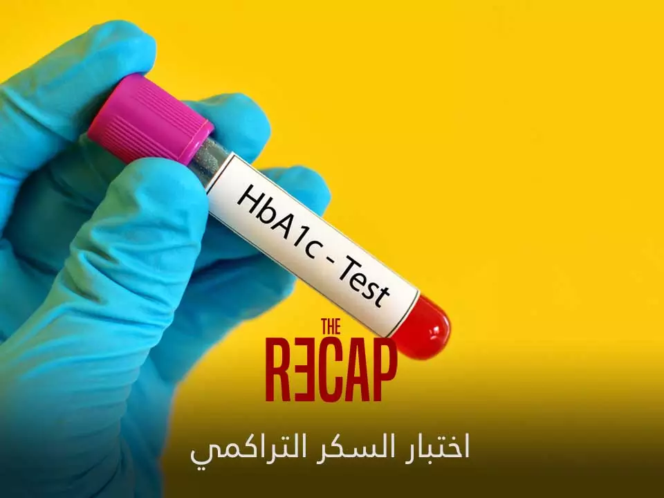 اختبار السكر التراكمي